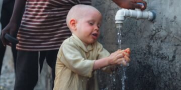 Global Health Equity Strategies 2026 — Global Health Equity Strategies 2026: Essential Access — Photo by Jonathan Shembere on Pexels